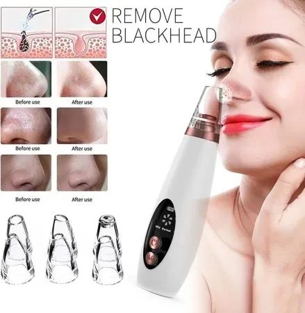 Blackhead Remover Instrument Black Dot Remover Acne Vacuum Suction Face Clean Black Head Pore Cleaning Beauty Skin Care Tool - Black Head Remover - Darma Roller